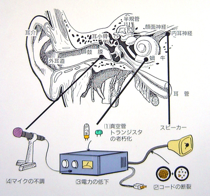 耳の老化をたとえると下図のように説明できます。