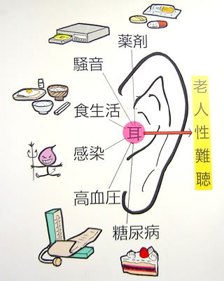 難聴を早める因子