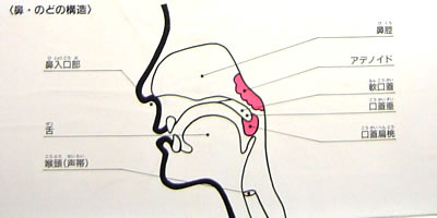 どのようにして起きるのでしょうか?